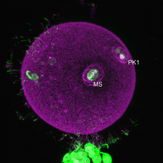 Abbildung 4 Bovine-MII-Oozyte_IF_2010_10_05