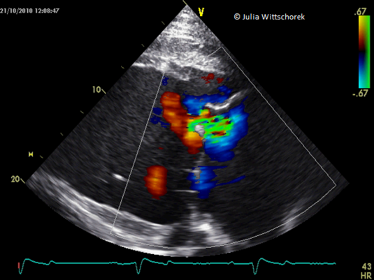 Bild 2 Echokardiographie