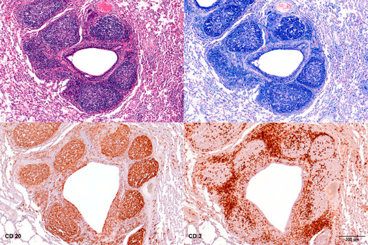 Pathologie Bild 06