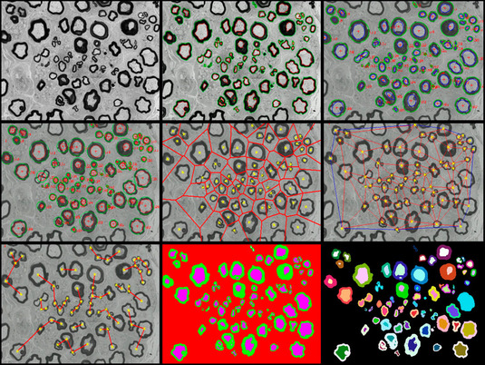 Pathologie Bild 08