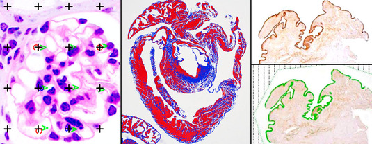 Pathologie Bild 10